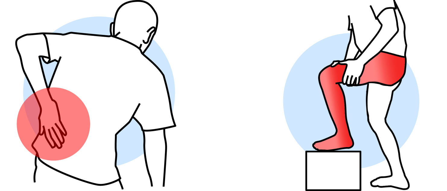 Backpain and Sciatica illustration
